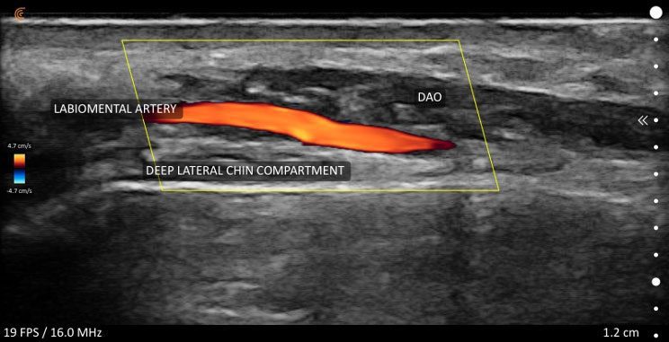 https://aexelbiomed.com.vn/wp-content/uploads/2026/06/Labiomental-Artery.jpg