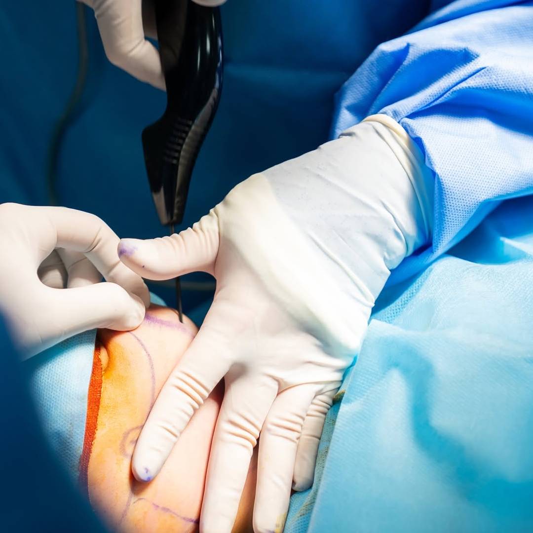 https://aexelbiomed.com.vn/wp-content/uploads/2026/09/IGNITERF-02.jpg
